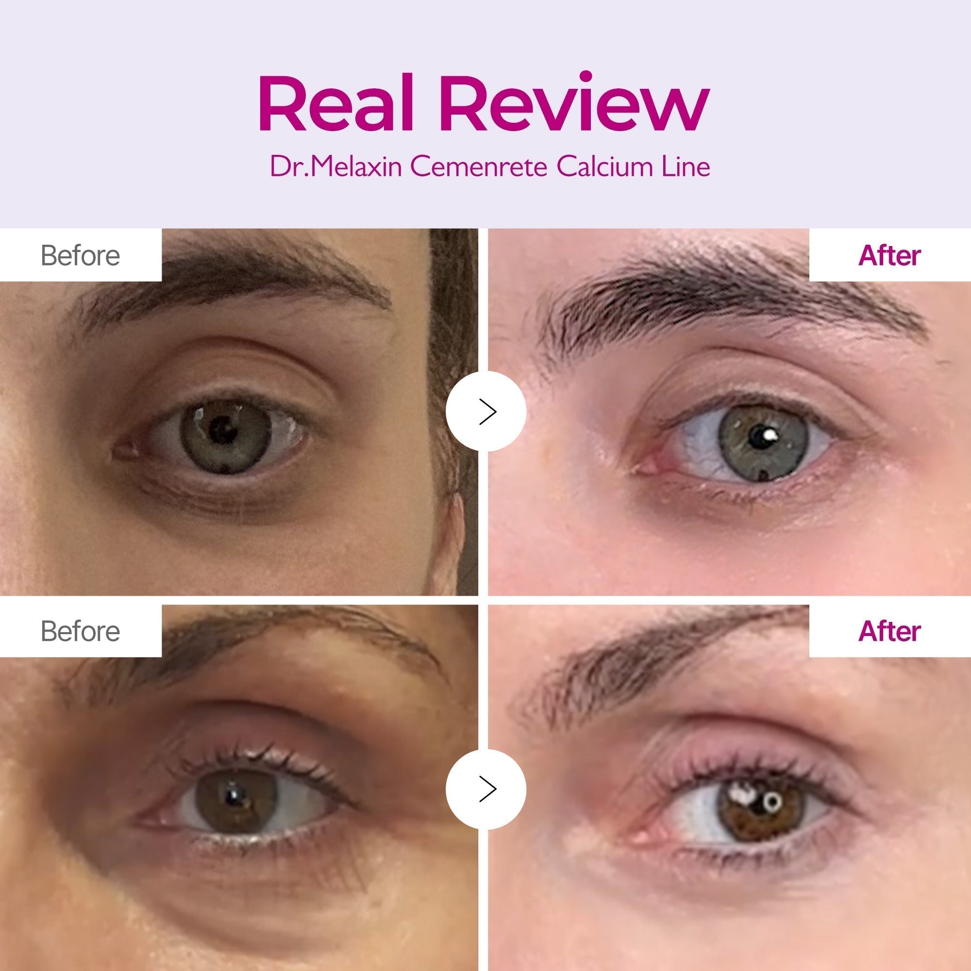 Cemenrete Calcium Eyecare Routine